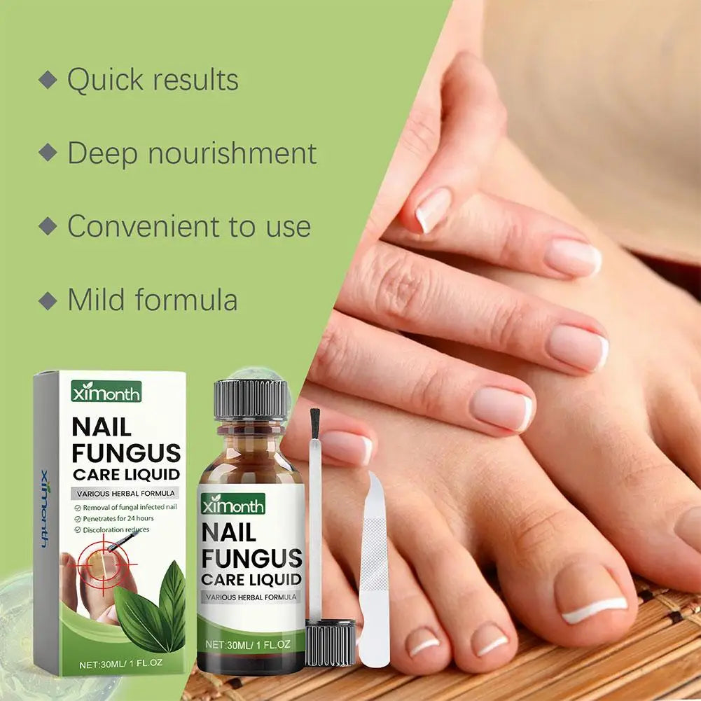 Onychomycosis Hand Foot Removal Repair Care Nail Fungal Treatment Serum Anti Infection Toe Fungus Paronychia 50g